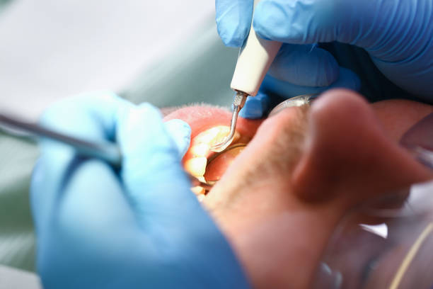 Best Emergency Dental Services for Seniors in Ashland, NJ