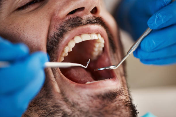 Best Emergency Dentist for Knocked-Out Tooth in Ashland, NJ